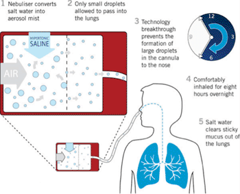 Image: Schematic representation of the tPAD device function (Photo courtesy of Parion Sciences).